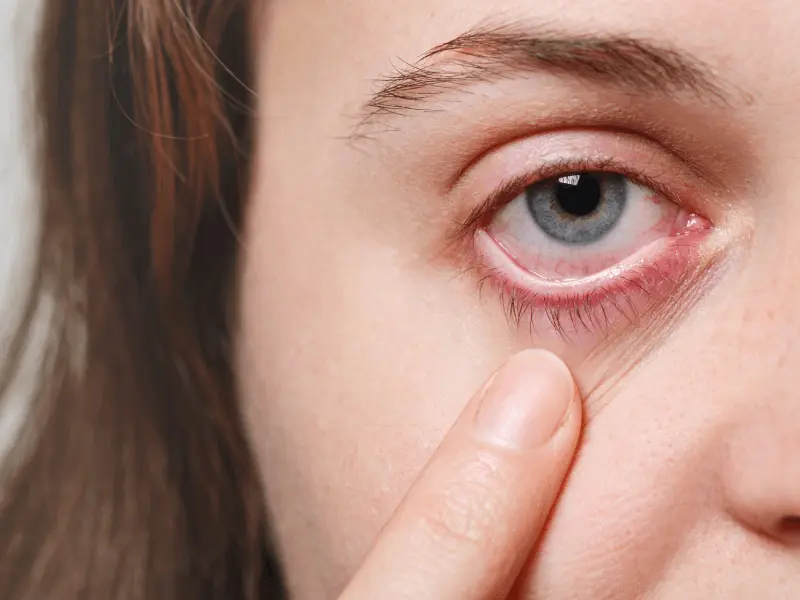 artist village optometry dry eye specialists artist village optometry dry eye specialists
